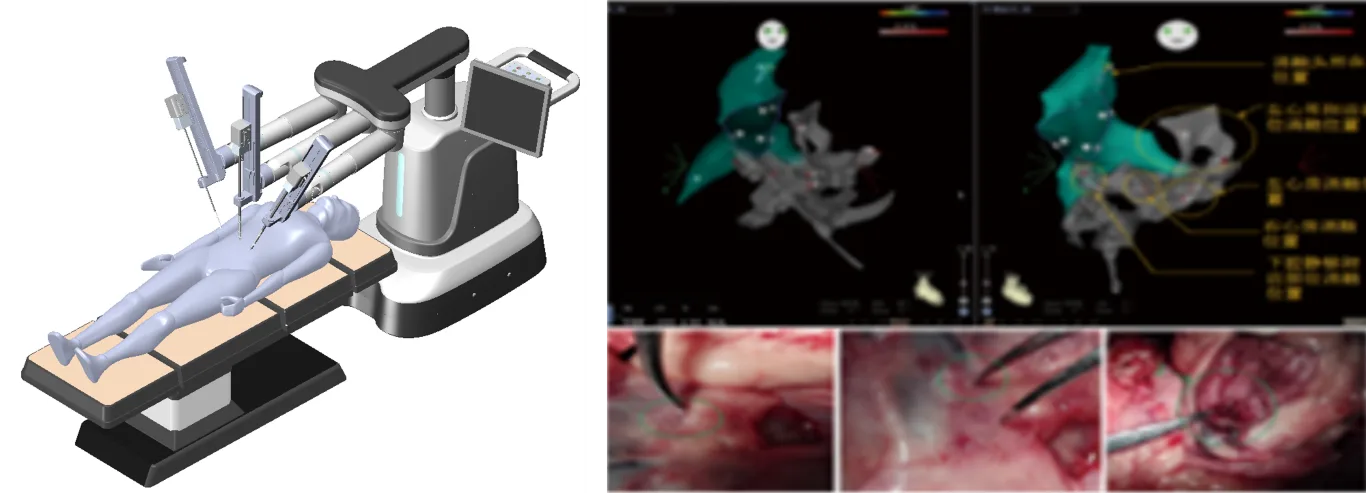 Autonomous Suture Robot System for Endoscopic Surgery