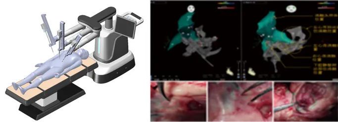 Autonomous Suture Robot System for Endoscopic Surgery